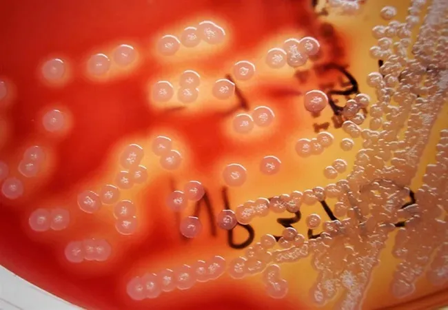 Vi khuẩn Bacillus pumilus gi&uacute;p tăng cường độ bền, độ uốn cho b&ecirc; t&ocirc;ng cốt sợi đay.